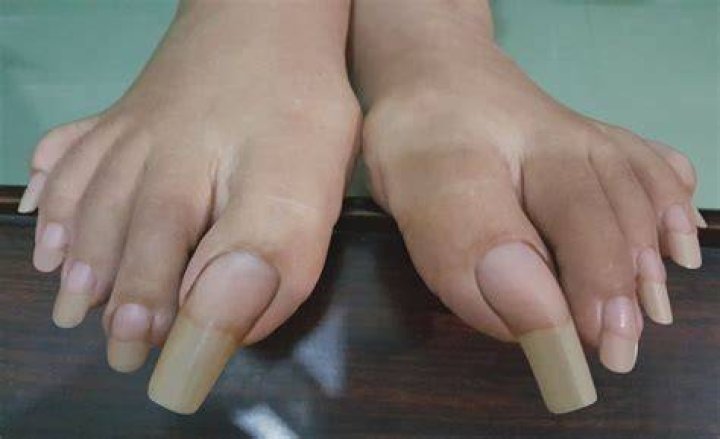 10 Extremely Long Toenails You Have To See In Order To Believe Page 2