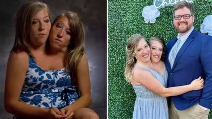 Abby And Brittany Hensel 2024 Did Abby Die Cyb Martina