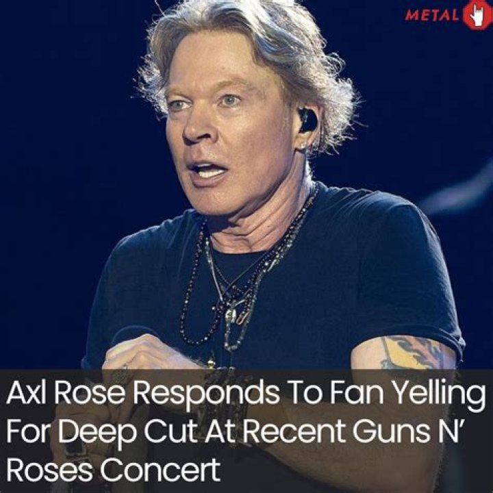 Axl Rose Responds to Fan's Microphone Injury Claim Got Music Talent