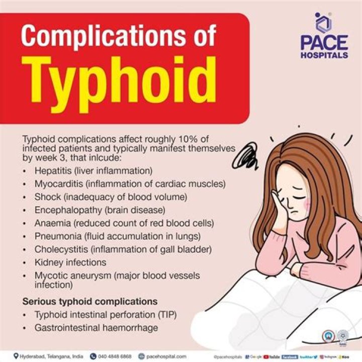 Can typhoid cause to death?