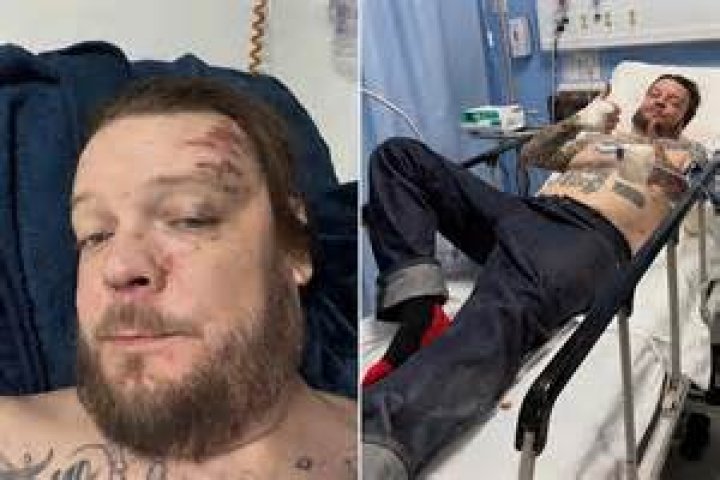 Corey Harrison Illness & Health condition 2024 Is He Sick?