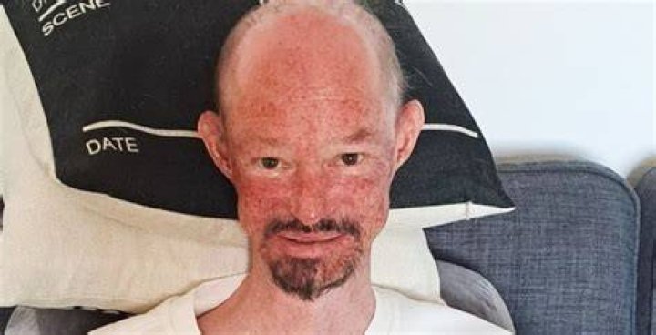 Darren Kent cause of death What illness did Darren Kent have? ABTC