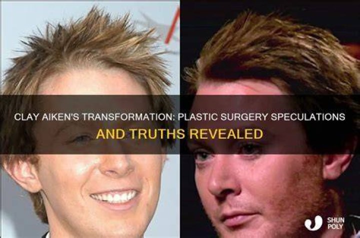 Did Clay Aiken Have Plastic Surgery? Everything You Need To Know