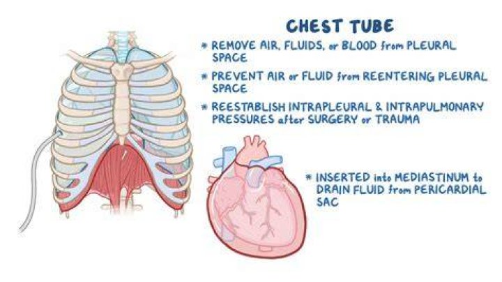 How long does it take to recover from thoracotomy surgery?