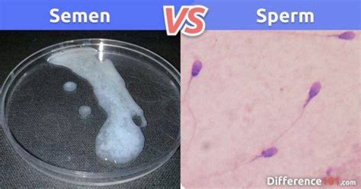 Is male sperm different from female sperm?