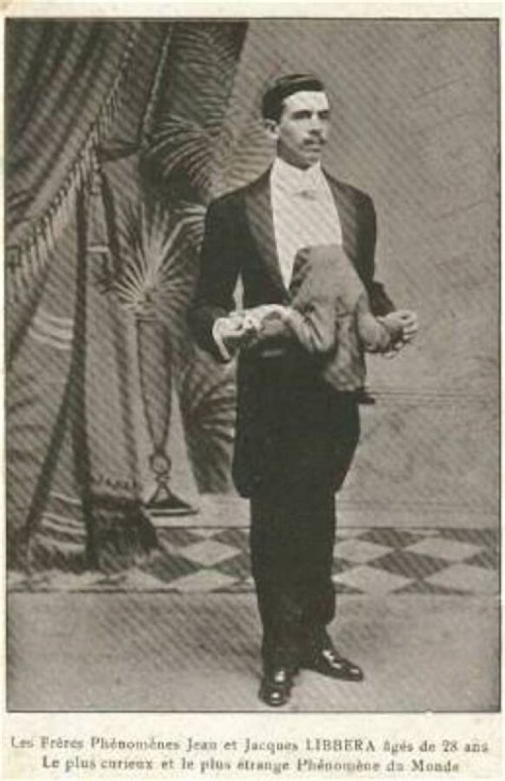 Jean Libbera Wikipedia Bio Who Was He? XRay Photos