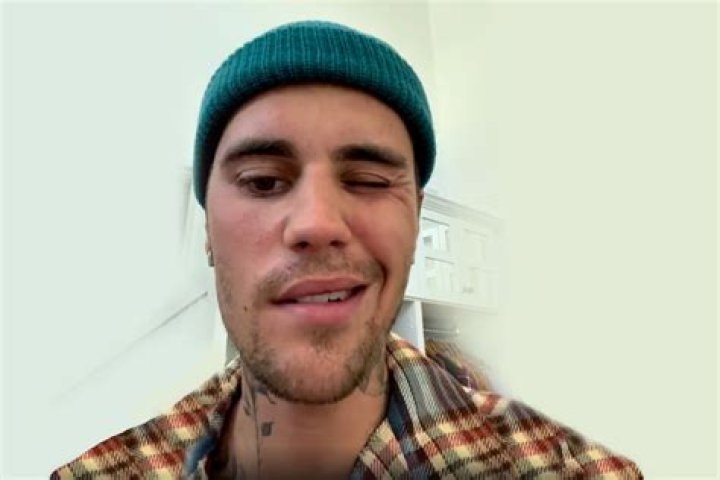 Justin Bieber reveals rare disorder behind facial paralysis AP News