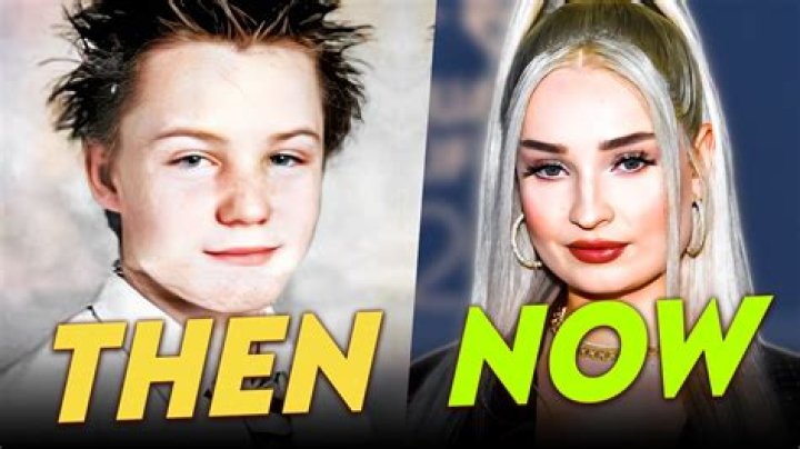 Kim Petras Before and After Transformation OtakuKart