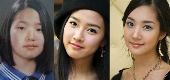 Park Min Young Plastic Surgery Before and After