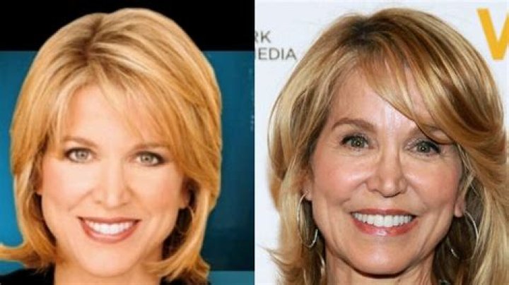 Paula Zahn Plastic Surgery Before And After