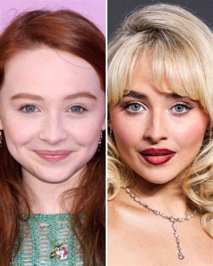 Sabrina Carpenter Plastic Surgery Before And After Photos