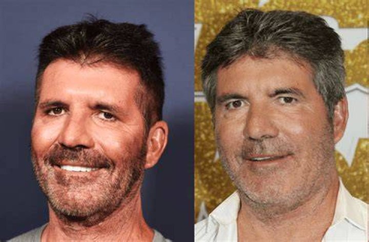 Simon Cowell Before And After Pictures What Happened With Simon Cowell?