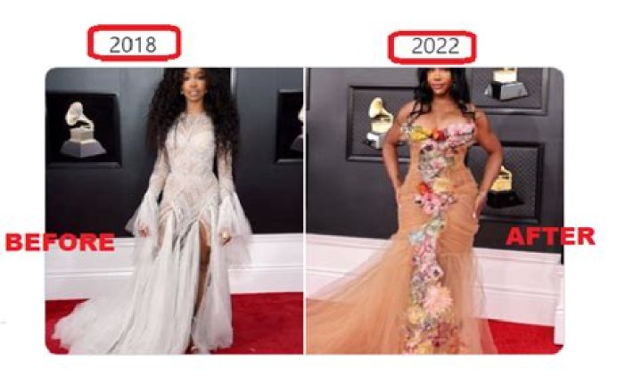 SZA Before And After BBL Did She Undergo Any Plastic Surgery?