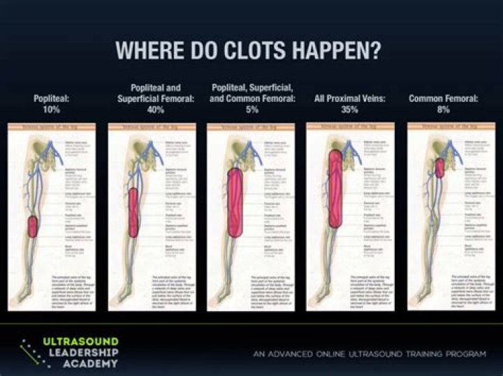 Ultrasound Leadership Academy Lower Extremity DVT &mdash; EM Curious