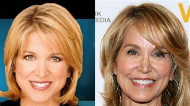 Unveiling The Truth: Paula Zahn's Plastic Surgery Journey Revealed