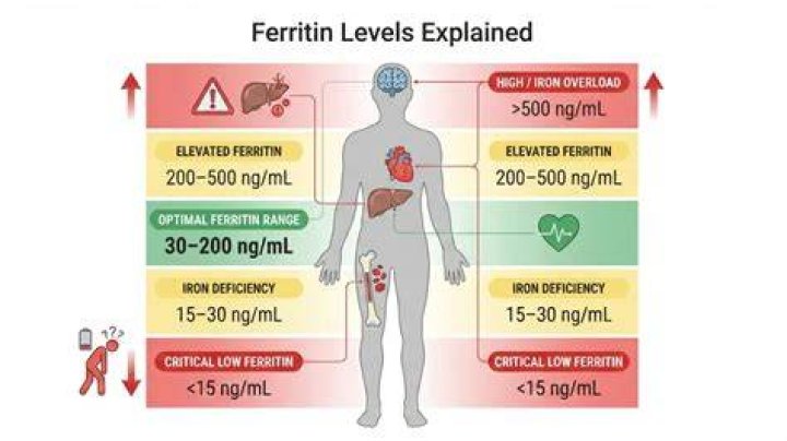 What A High Ferritin Level Can Indicate: Understanding Its Significance