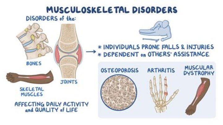 What are the symptoms of musculoskeletal disorders?