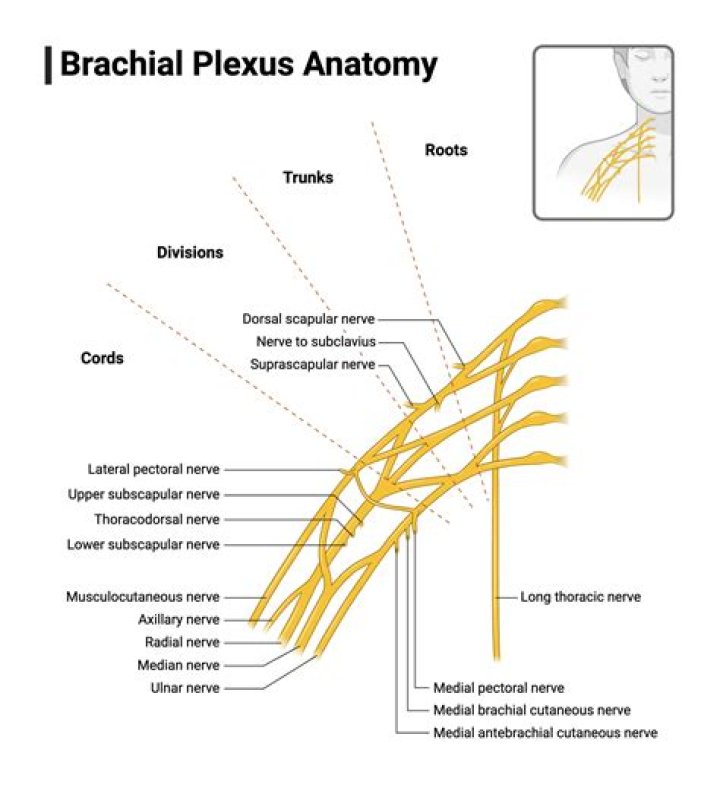 What causes brachial plexus neuropraxia?