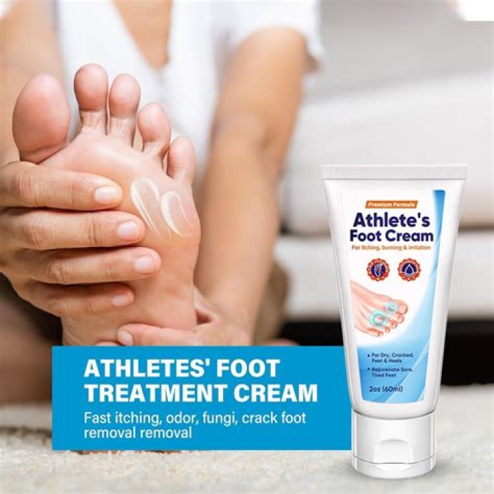 What cream is good for foot pain?