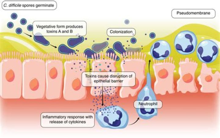 What event triggers an infection by Clostridium difficile?