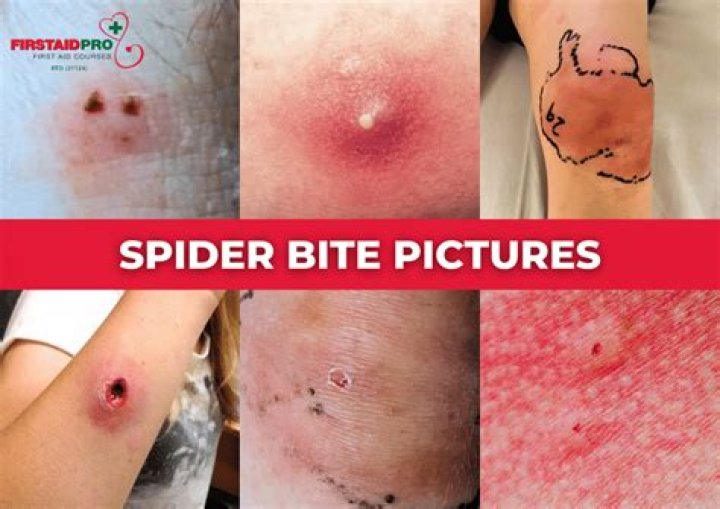What happens if a cane spider bites you?