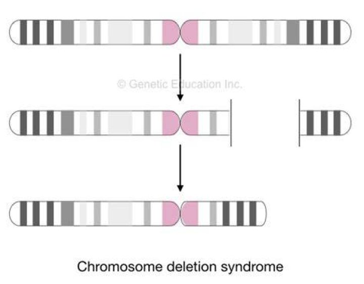 What is chromosome deletion?