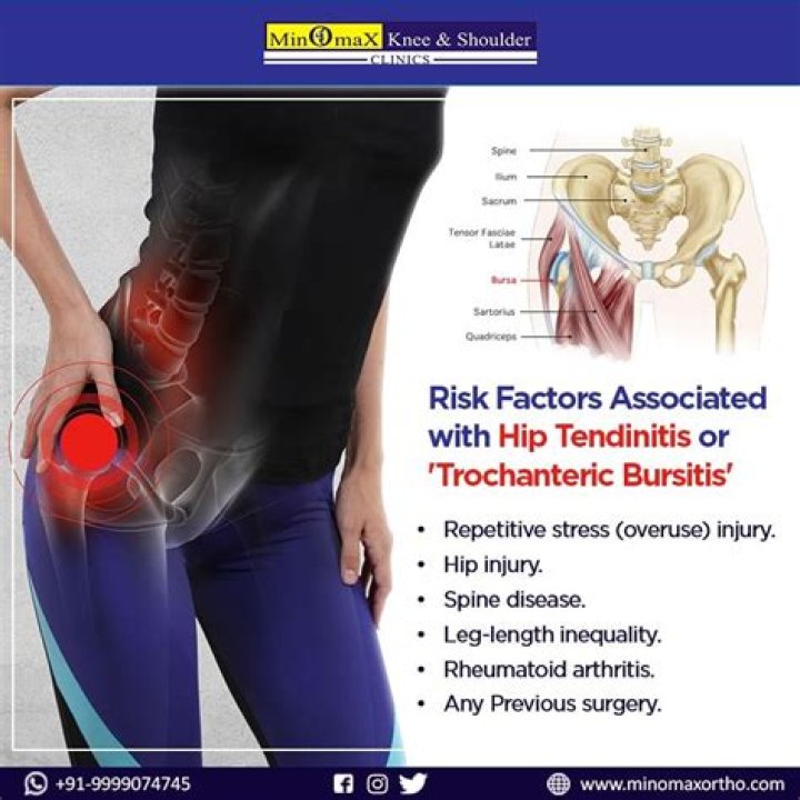 What is trochanteric Tendinopathy?