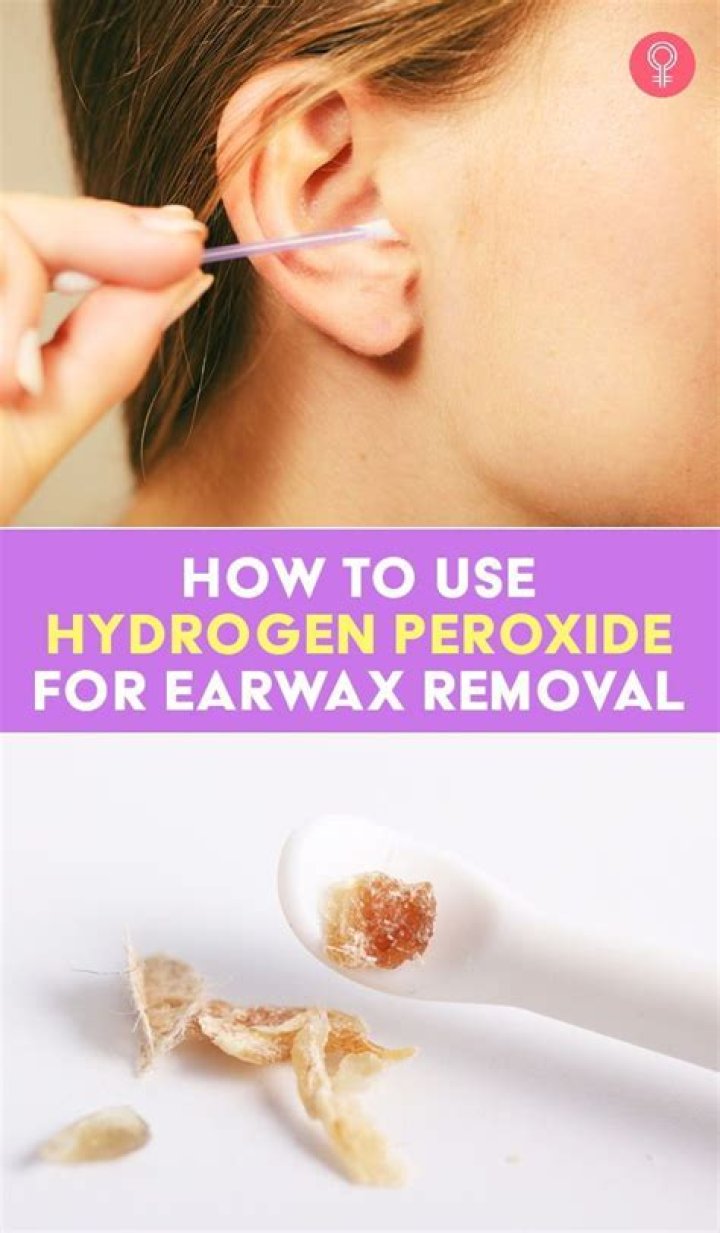What percentage of hydrogen peroxide is safe for ear wax removal?