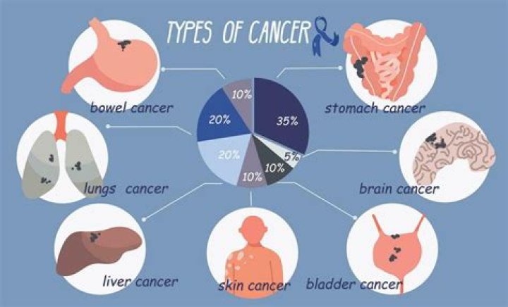 What type of cancer did OJ Simpson have? Here's what we know